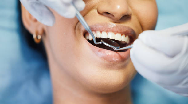 Best Emergency Wisdom Teeth Removal in Joseph, OR